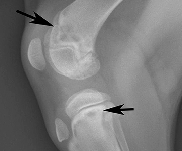 Photo: This radiograph shows the typical changes seen in a dog with HOD; this 3-month-old Labrador retriever presents with lethargy, pain and collapse.